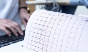 EKG wydruk 300x177 - EKG wydruk